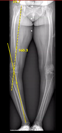 Radiographic Imaging